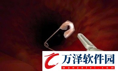大腸的復(fù)仇